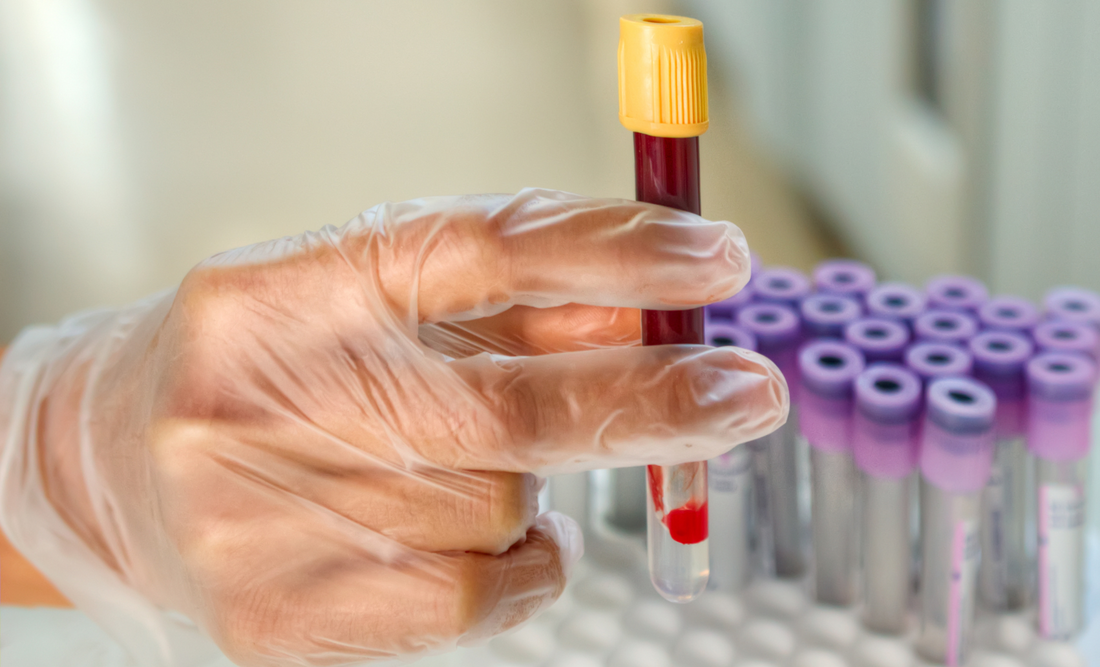 How Long Does Bacteriostatic Water Last?