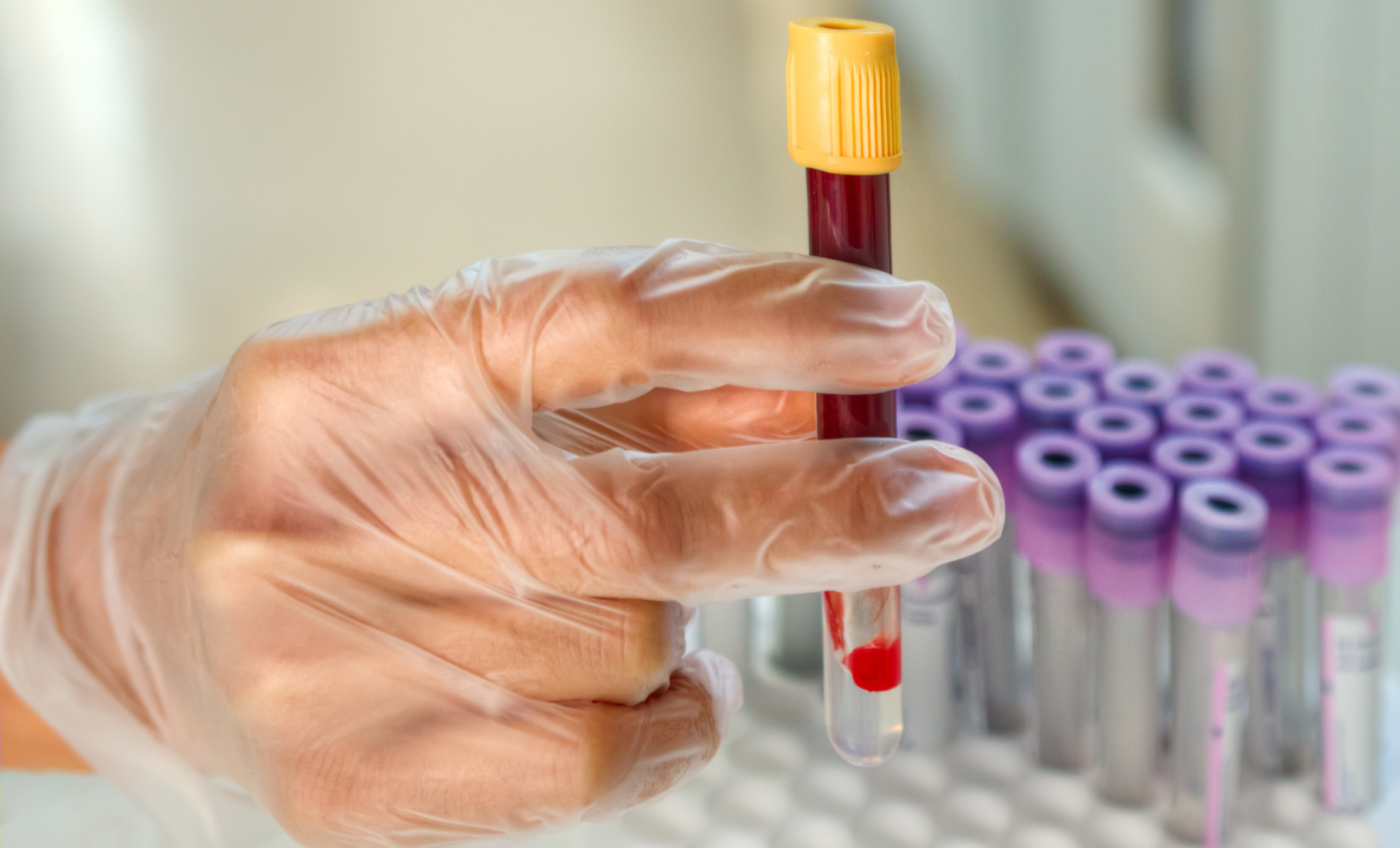How Long Does Bacteriostatic Water Last?
